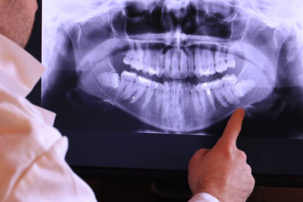 Best Broken or Chipped Tooth Repair in Citronelle, AL
